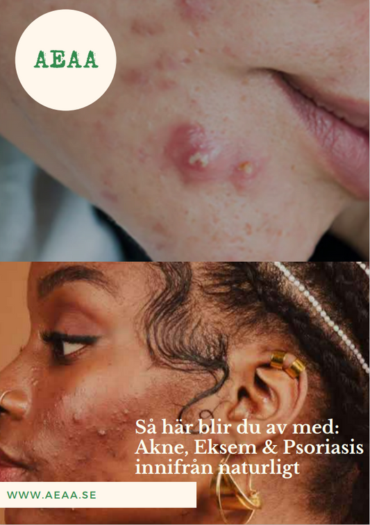 Så här blir du av med Akne, Psoriasis & Eksem